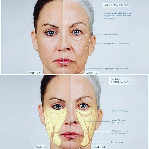 Aging skin comparison, causes at different ages.