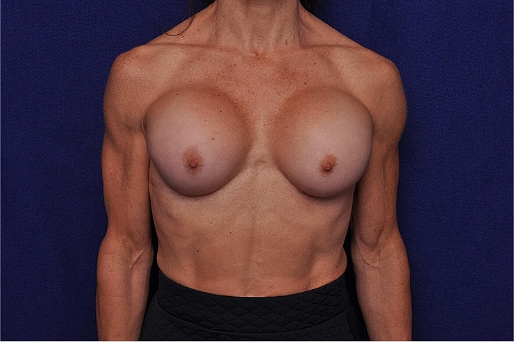 Female torso with visible muscle definition.