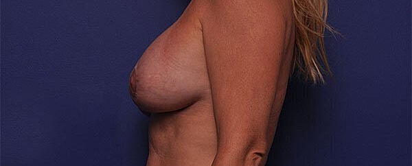 Side profile of a woman against a blue background.