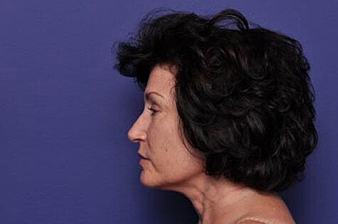 Profile of a woman against a purple background.