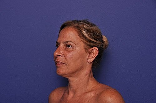 Profile of a woman against a purple background.
