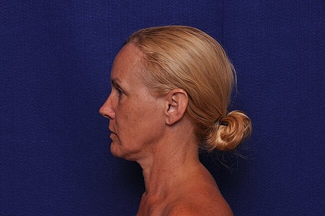 Profile portrait of a woman with blonde hair.