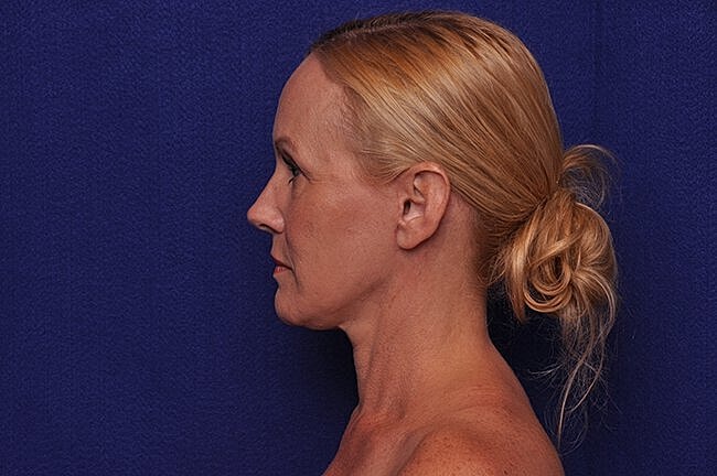 Profile of a woman against a blue background.