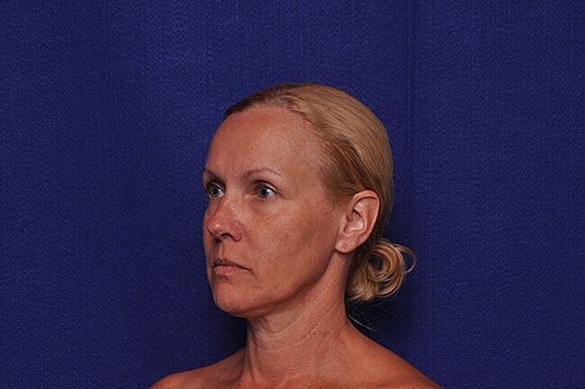 Profile of a woman against a blue background.