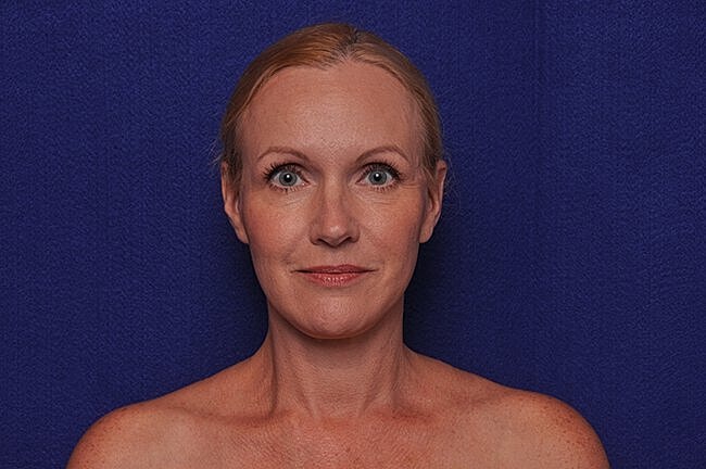 Woman with neutral expression against blue background.