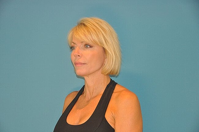 Woman in black tank top against blue background.