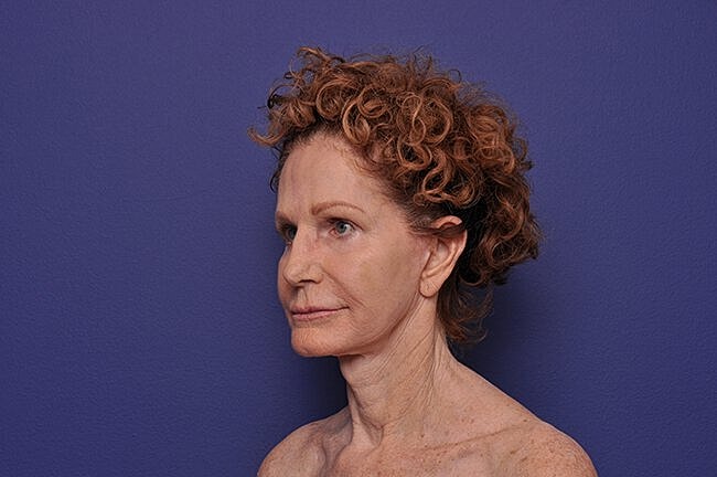 Profile of a woman with curly hair.