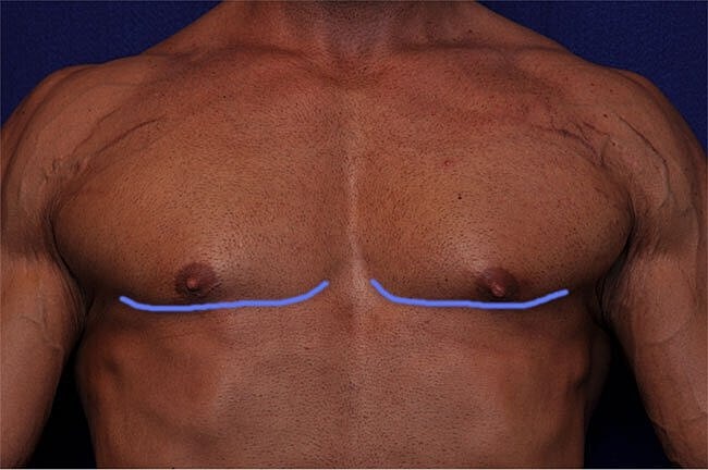 Male torso with blue markings across chest.