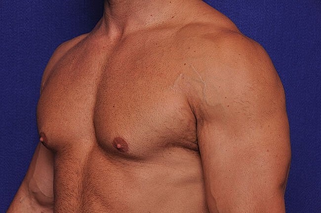 Male torso against a blue background.