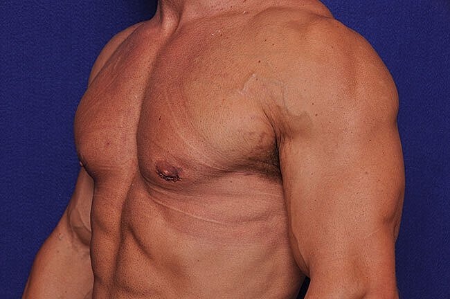 Muscular torso against a blue background.