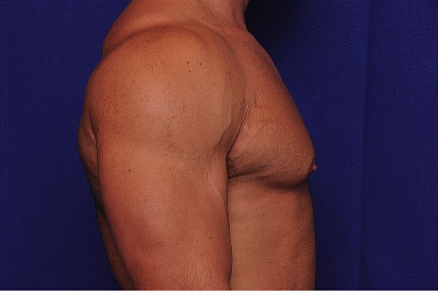 Side profile of male torso against blue background.