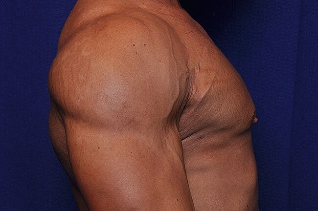 Close-up of muscular shoulder and arm.