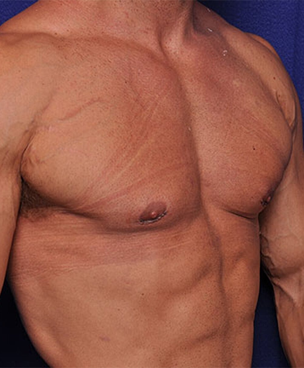 Close-up of muscular chest and torso.