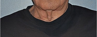 Close-up of neck and collar area.