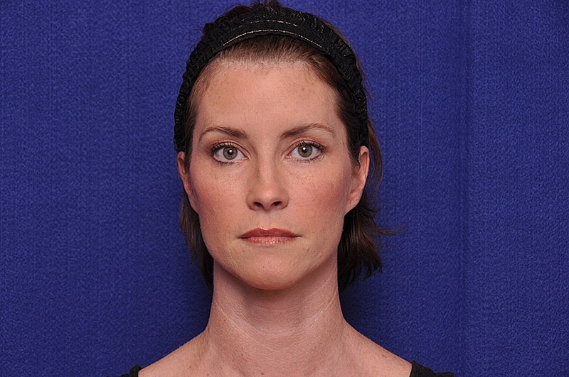 Woman with short hair against blue background.