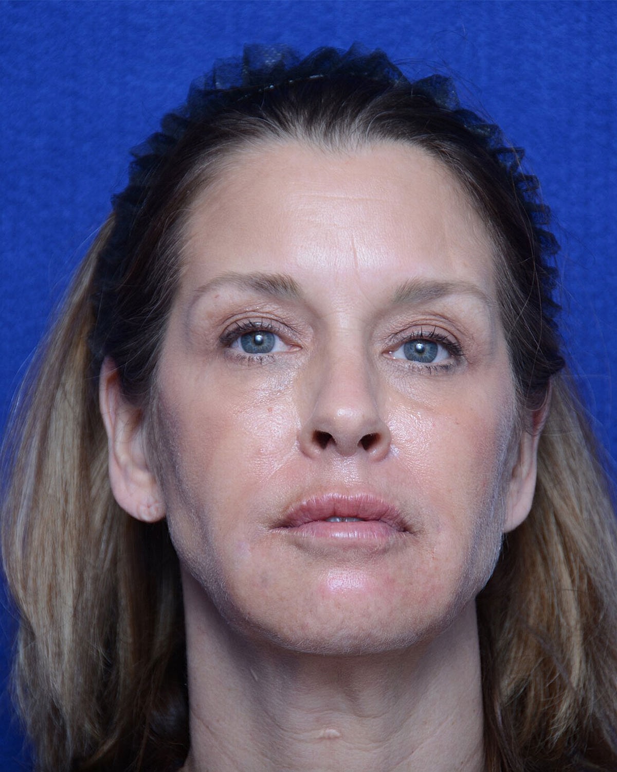 Smiling woman in stylish dress, arms crossed.