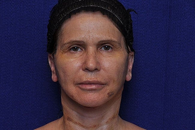 Woman with clear skin on blue background.