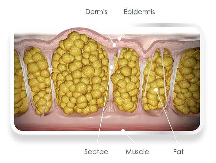 Anatomy of skin layers and adipose tissue.