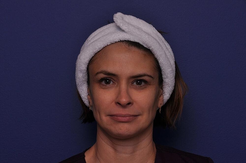 Chemical Brow Lift Before & After